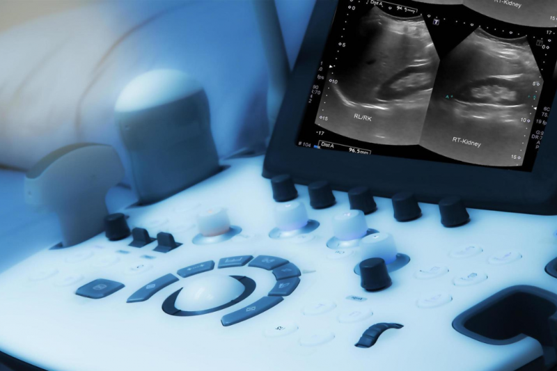 Descubra Tudo Sobre o Ultrassom Abdominal e Seus Benefícios