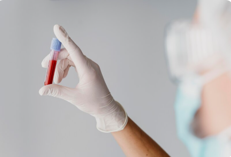 Exame hemograma completo: O que você precisa saber e como interpretar resultados